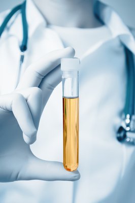 Urine Drug Test