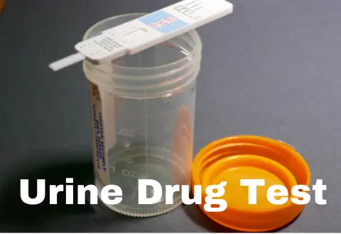 Urine Drug Test