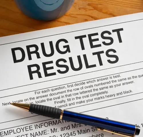 Does CBD Show Up on a Drug Test?